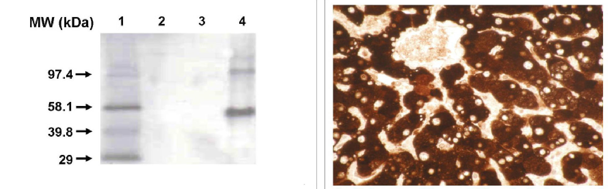 "
Left: Western blot using CYP1A2 antibody (Cat. No. X2046M) on recombinant (2) CYP1B1, (3) CYP1A1 and (4) CYP1A2 (0.5 pmol per lane).
Right: Immunohistochemical staining of formalin-fixed, paraffin-embedded normal human liver tissue section."